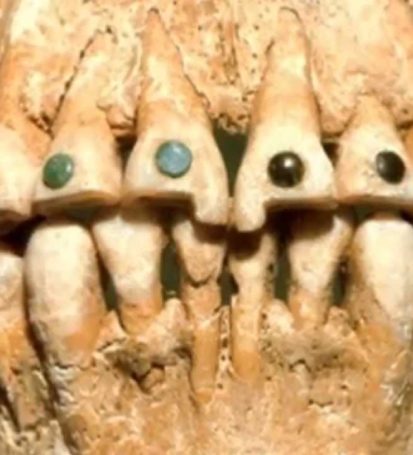 History of ancient dentistry